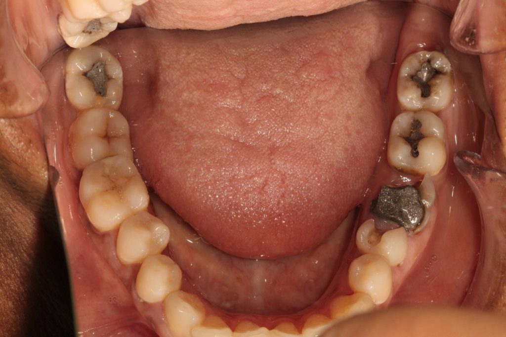 7 causes of Tooth Pain