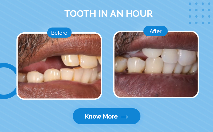 Dental Clinic in Mogappair Dental clinic in Chennai