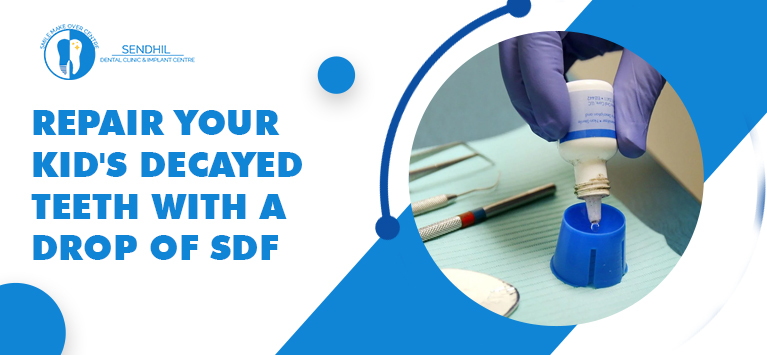 SDF Treatment | SDF Dental Treatments