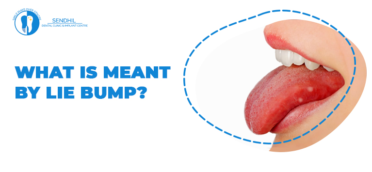 What causes lie bumps on the tongue?