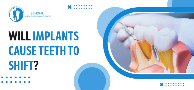 Will implants cause teeth to shift? - Senthil Dental Clinic
