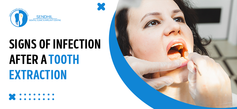 Signs of Infection After a Tooth Extraction